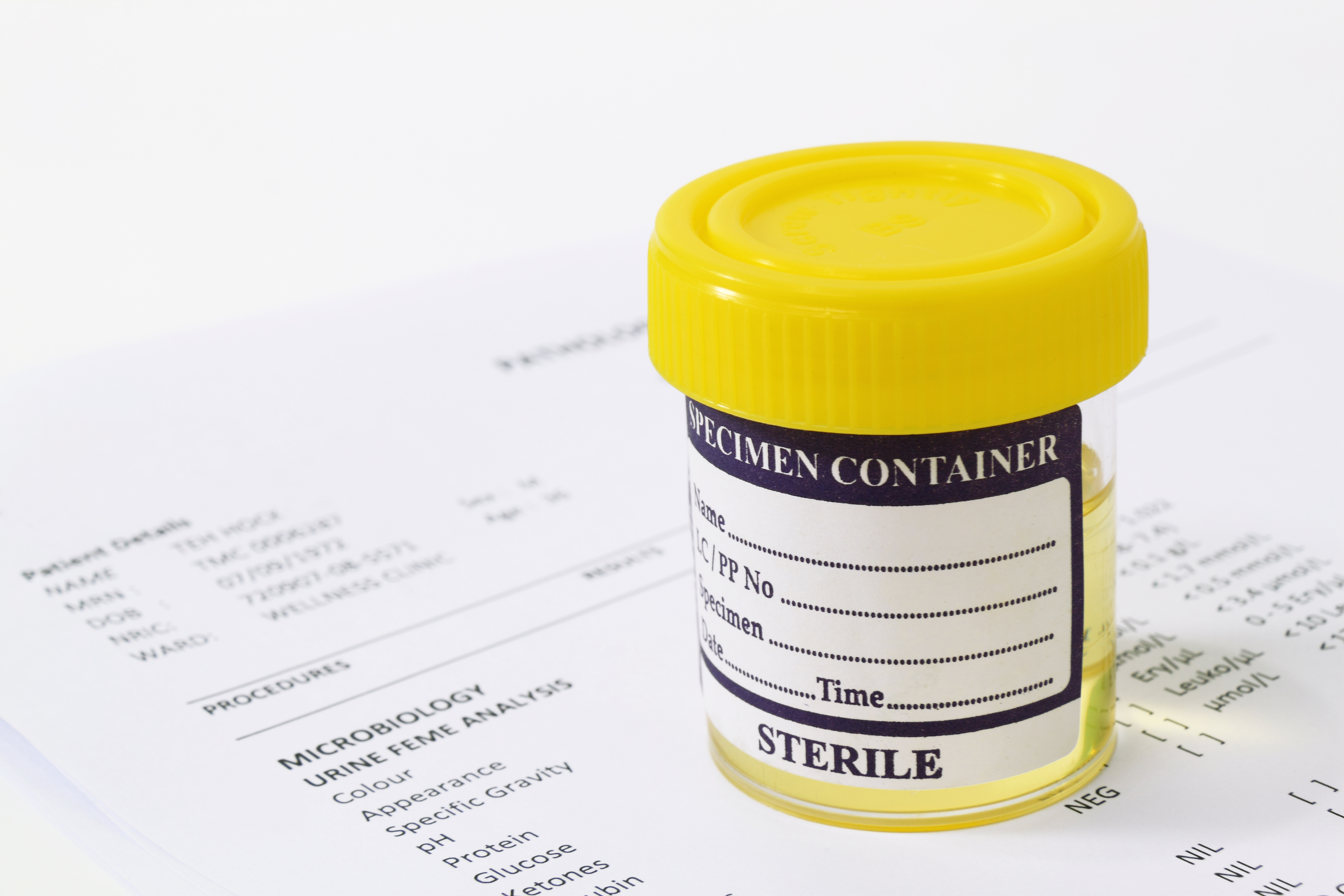 How to beat drug test